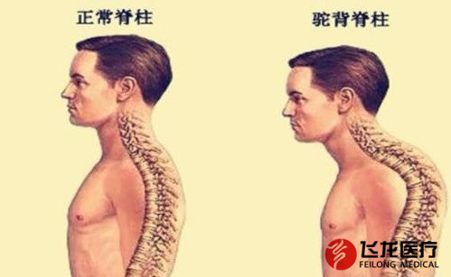 脊柱健康，不向生活&ldquo;低頭&rdquo;