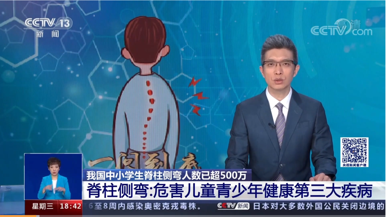 青少年脊柱側彎現狀堪憂